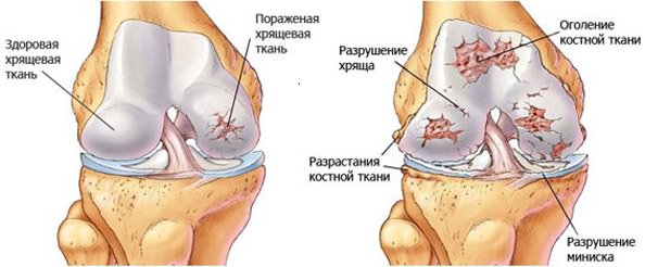 Анатомия коленного сустава10