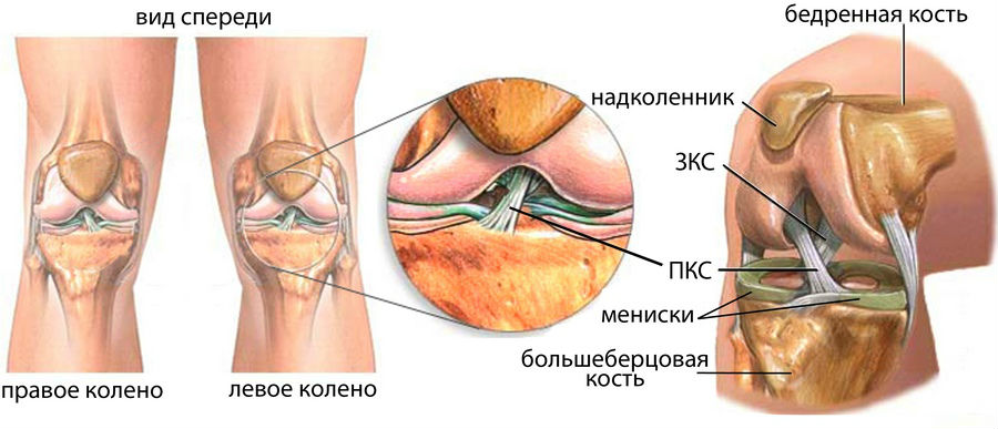 Повреждения связок коленного сустава11