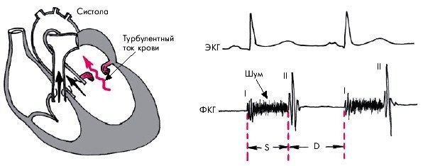 Классификация врожденных пороков сердца14