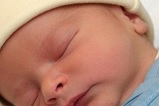 Водянка яичка у новорожденных и детей