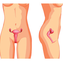 Гипоплазия матки: степени, лечение, симптомы, фото1