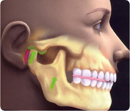 Окклюзия зубных протезов1
