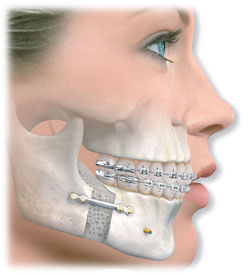История челюстно-лицевой хирургии1