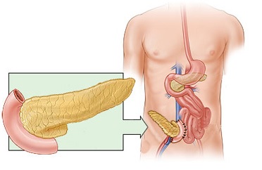 Трансплантация поджелудочной железы1