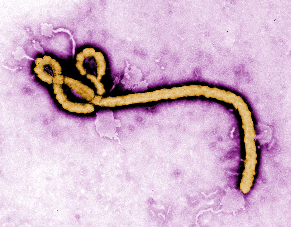 Лихорадка Эбола2
