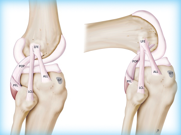 Повреждения связок коленного сустава2
