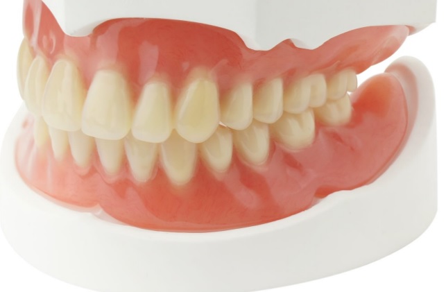 Установка несъемного зубного протеза2