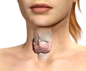 Гиперплазия щитовидной железы2