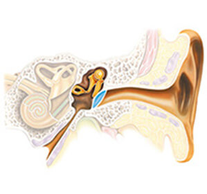 Неврит слухового нерва: причины, симптомы, лечение2