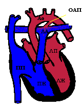 Открытый артериальный проток2