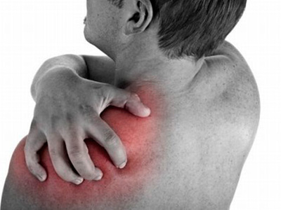 Плечевой плексит: симптомы, лечение, гимнастика2