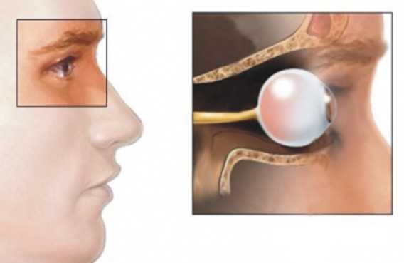 Эндокринная офтальмопатия: симптомы, причины, лечение2