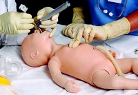 Интубация трахеи у новорожденных