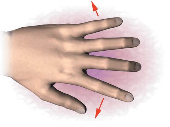 Восстановление пальцев кисти3