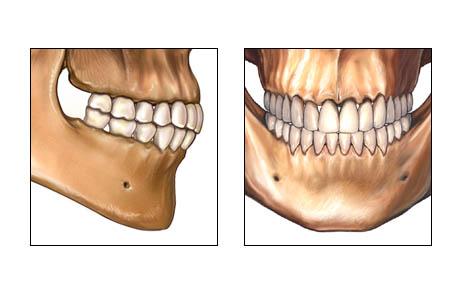 Окклюзия зубных протезов3