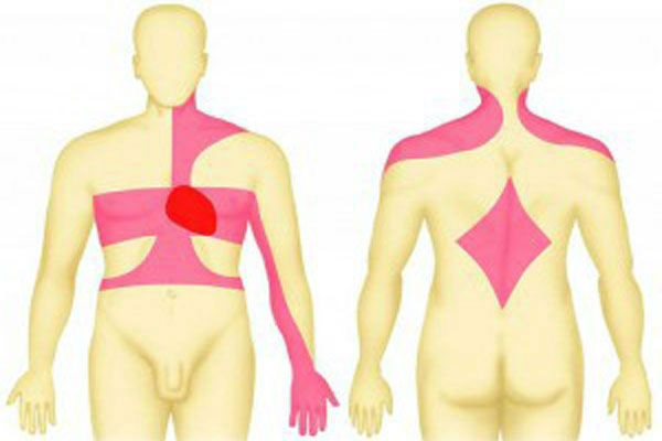 Почему болит между грудью: причины, последствия, методы диагностики3