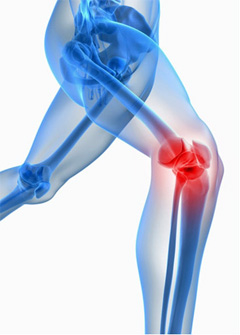 Подготовка к эндопротезированию коленного сустава4