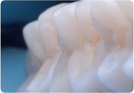 Протокол реставрации зубов4