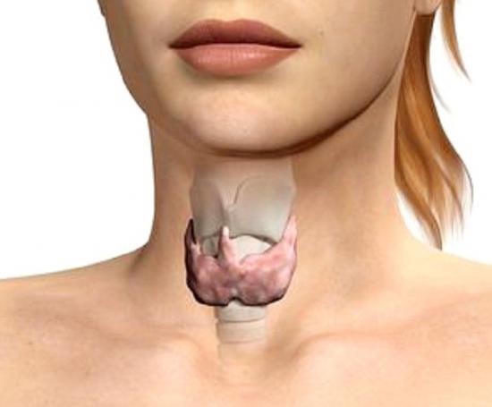 Гипоплазия щитовидной железы4
