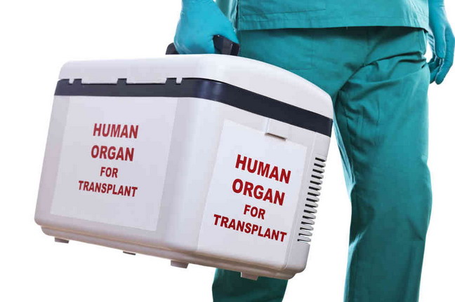 Посмертная трансплантация органов4