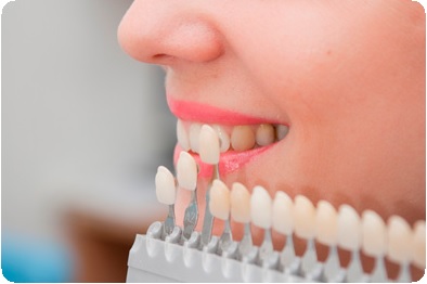 Особенности восстановления передних зубов5