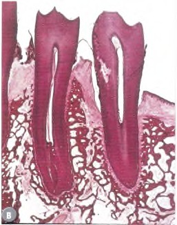 Окклюзия зубных протезов5