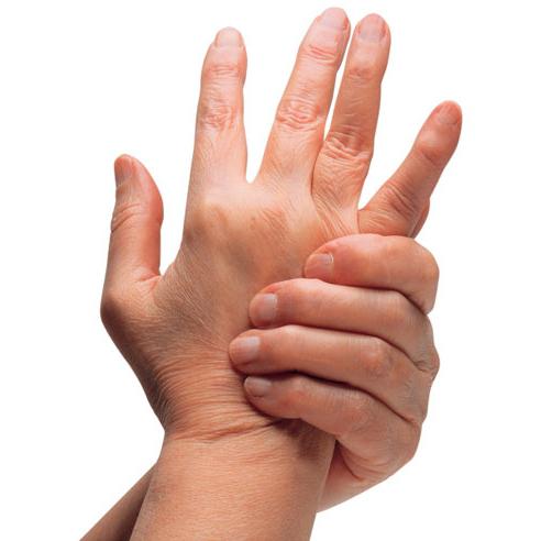 Артрит пальцев рук: симптомы, лечение5