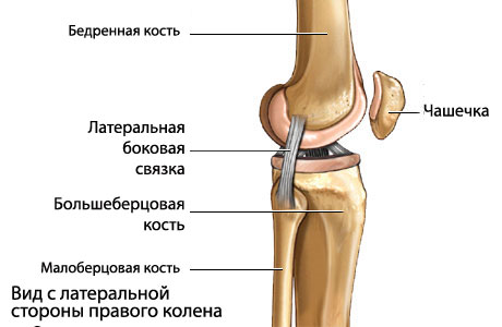 Перелом костей коленного сустава6