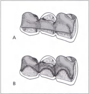 Протокол реставрации зубов6