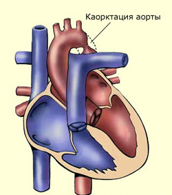 Оценка состояния сердечно-сосудистой системы6