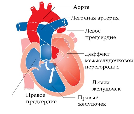 Диагностическая катетеризация сердца6