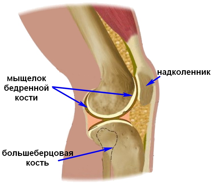 Перелом костей коленного сустава7