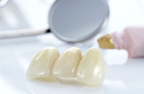 Установка несъемного зубного протеза8