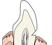 Окклюзия зубных протезов8