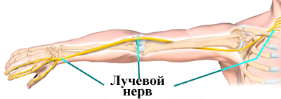 Боль в плечевом суставе: симптомы, лечение, причины, дискомфорт при поднятии руки10