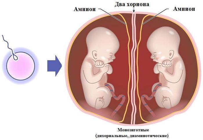 Беременность двойней: диагностика, ведение беременности11
