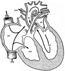 Анастомоз легочной артерии13