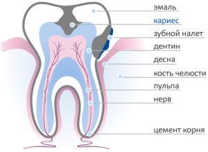 Препарирование зуба: показания, этапы, методы, последствия14
