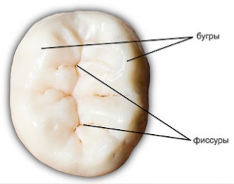 Препарирование зуба: показания, этапы, методы, последствия15