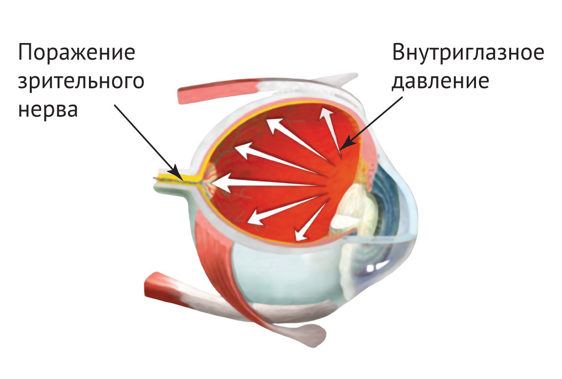 Ухудшение зрения: симптомы, причины, лечение, что делать. Категория болезни глаз. 15
