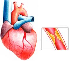 Анастомоз легочной артерии17