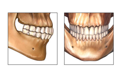 Методика препарирования зубов: показания, этапы18