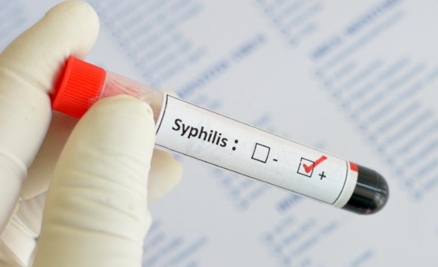 Диагностика и профилактика врожденного сифилиса 1