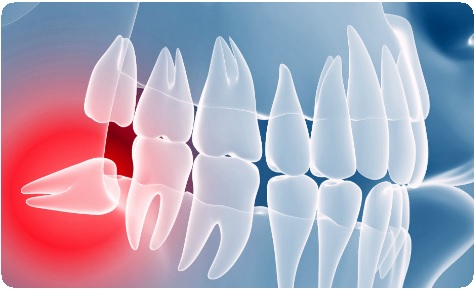Ретенция зуба и другие дополнительные меры при реставрации1