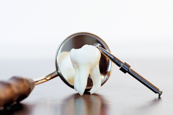 Почему болит зуб после удаления: причины, диагностика, лечение, фото1