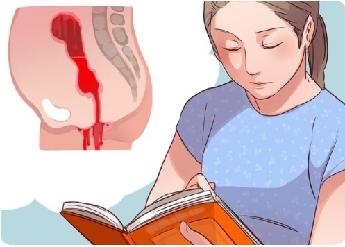 Послеродовое кровотечение: ранее и позднее1