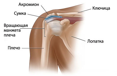 Боль в плечевом суставе: симптомы, лечение, причины, дискомфорт при поднятии руки1