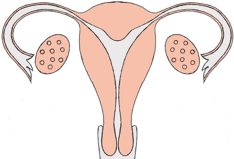 Седловидная матка: причины, особенности беременности1
