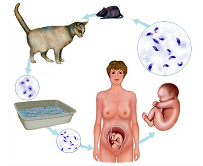 Инфекции при беременности. Оценка эффективности лечения21
