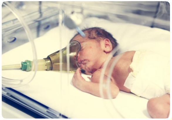 Асфиксия новорожденного: степени, реанимация, последствия2